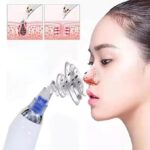4 In 1 Multi-Function Blackhead Whitehead Extractor Remover Device Facial Cleansing Tool,Skin Cleaner,Pimple Removal Tool,Acne Pimple Pore Cleaner Vacuum Suction Tool For Men & Women (MULTI) - Image 4