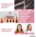 RENESMEE Scalp Massager Shampoo Brush, Eco-friendly Wheat Straw body with Soft Silicon Bristles, Hair Scalp Scrubber, Scalp Exfoliator | Dandruff Removal, Prevents Hair loss (Pink) - Image 3